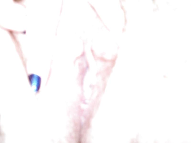 My Album #4260896