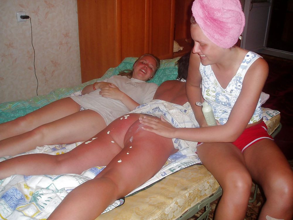 Sun burned girl #4515453