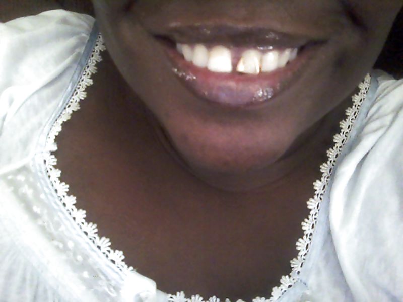 Lippen, Lächeln ... Zunge #22275815