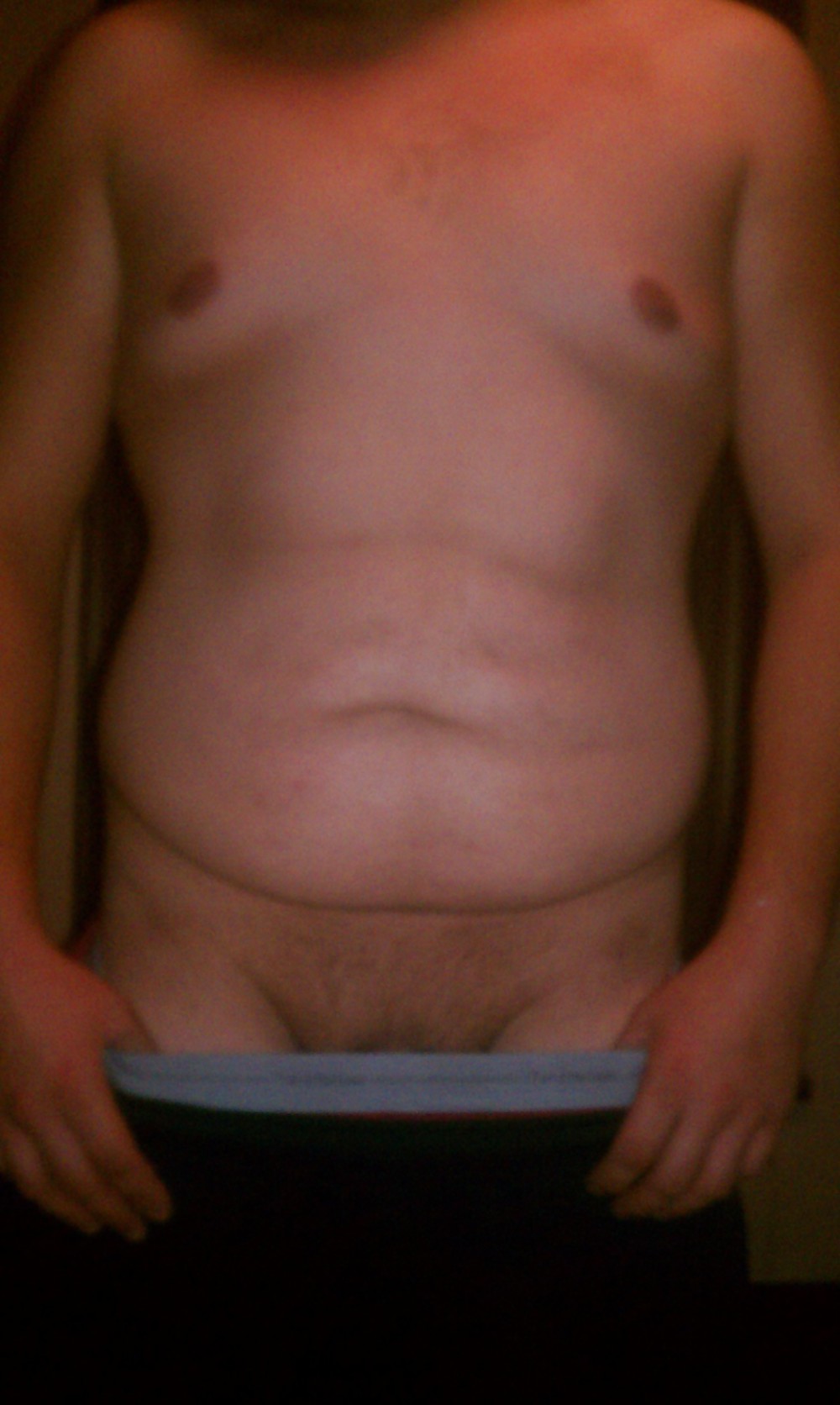 El
 #22064355