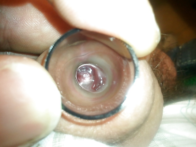 Dilatando con tapon trasparente
 #4840456