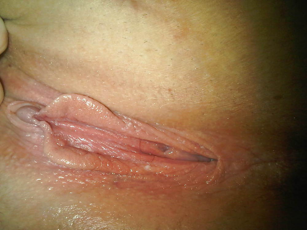 Ash2 #4291883