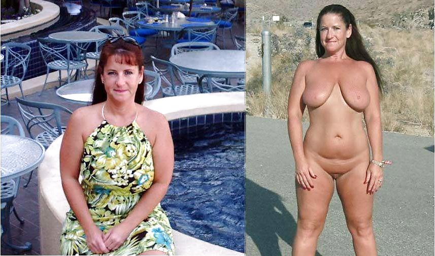 Before after 313 (saggy tits special) #3594104