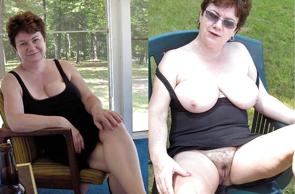 Before after 313 (saggy tits special) #3594121