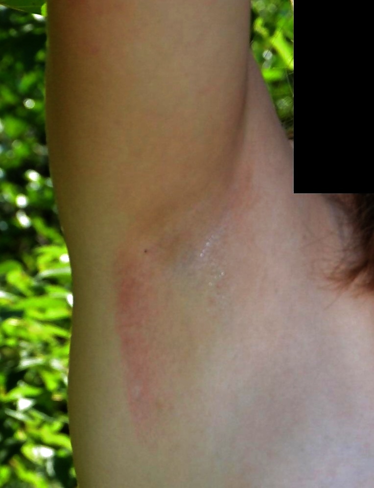 ARMPITS FETISH I #14720403