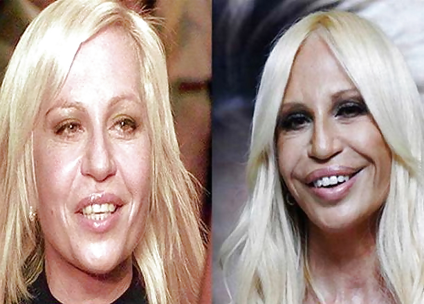 Bad Plastic Surgeries   #1429438