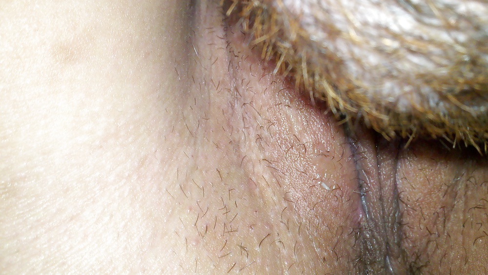 Ex fat pussy lips #5713732