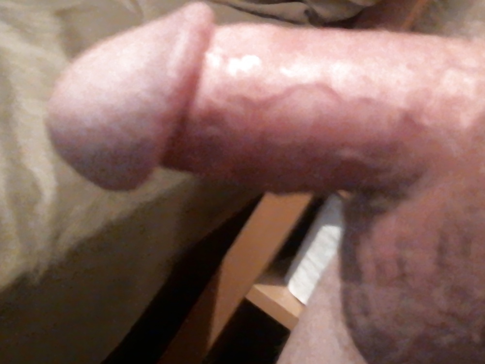 Showing #19091572