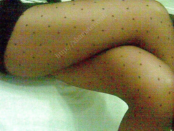 Turkish Amateur mix 3 #3947582