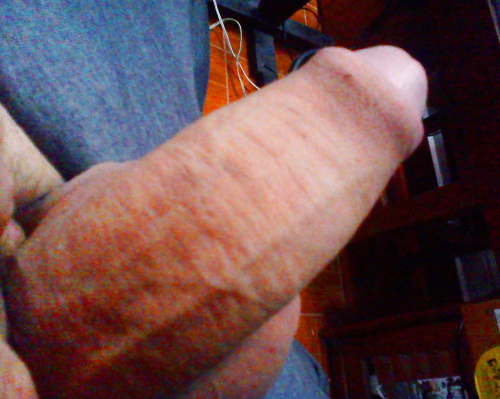 Conozca la basura de glowfox 
 #20289218