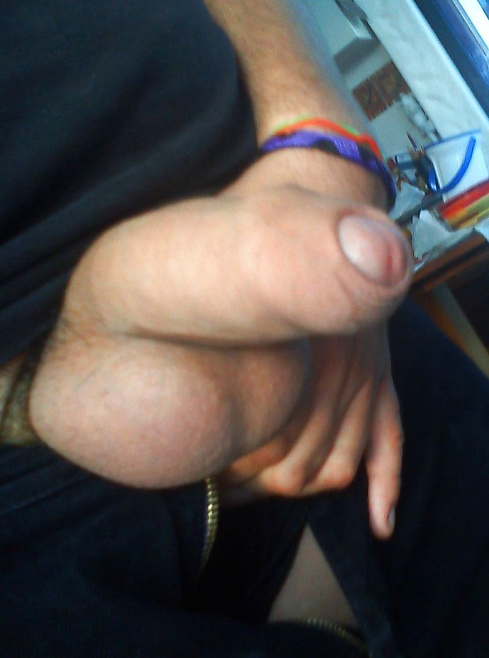 Conozca la basura de glowfox 
 #20289249