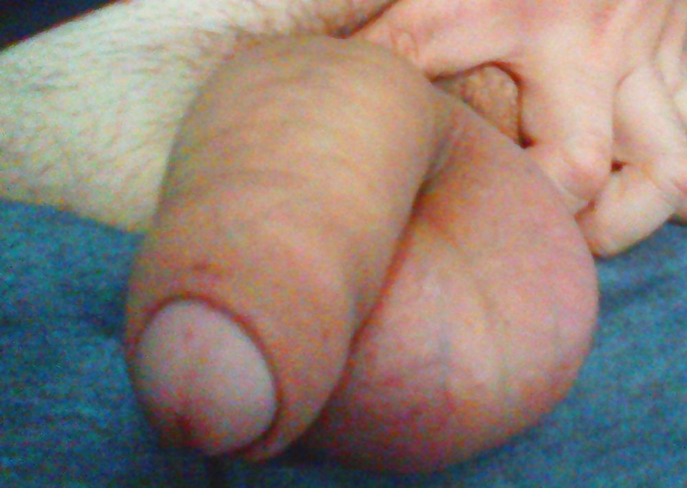 Conozca la basura de glowfox 
 #20289281