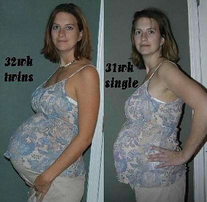 妊娠前と妊娠後のお腹
 #20204914