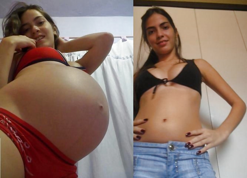 Antes y después de barrigas embarazadas
 #20204919