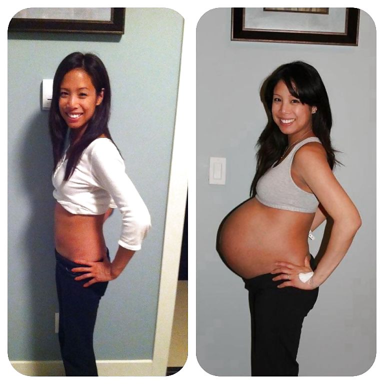 Antes y después de barrigas embarazadas
 #20204934