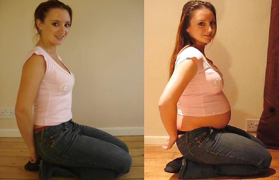 Antes y después de barrigas embarazadas
 #20204938
