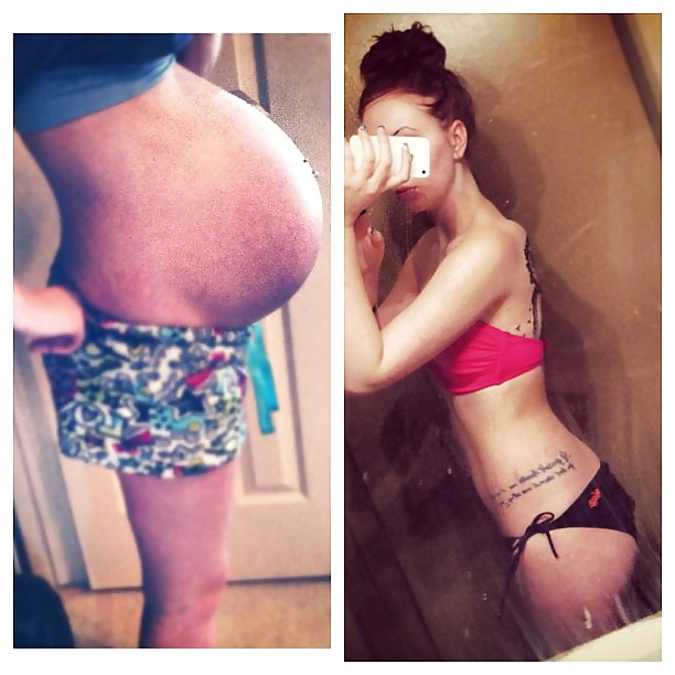 Antes y después de barrigas embarazadas
 #20204949