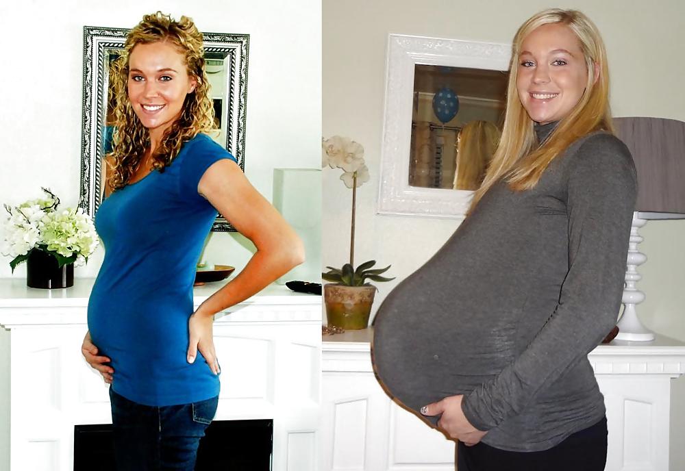 Antes y después de barrigas embarazadas
 #20204955