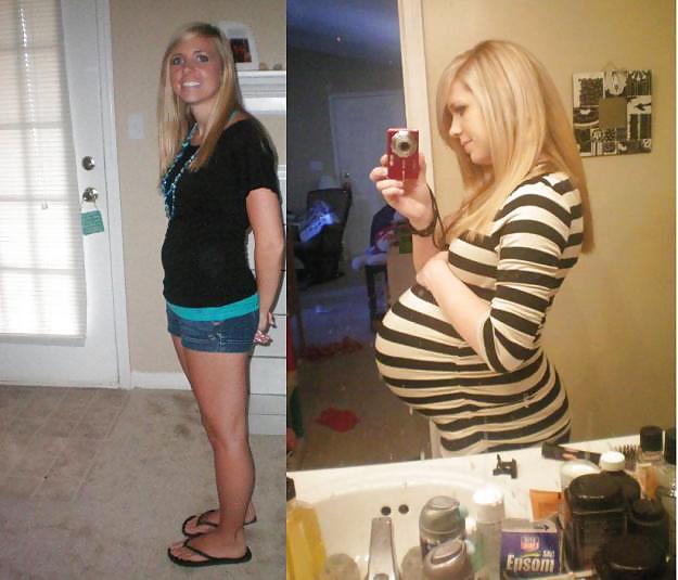 Antes y después de barrigas embarazadas
 #20204967