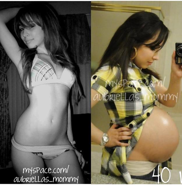 Antes y después de barrigas embarazadas
 #20204976