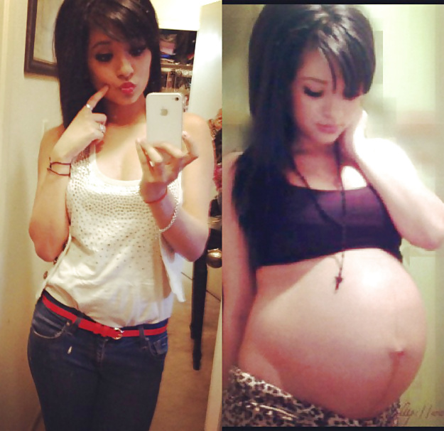 Antes y después de barrigas embarazadas
 #20204984