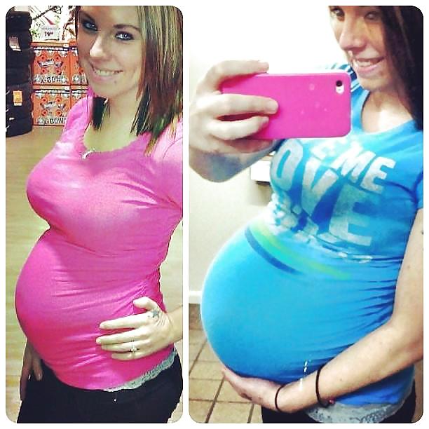 Antes y después de barrigas embarazadas
 #20204992