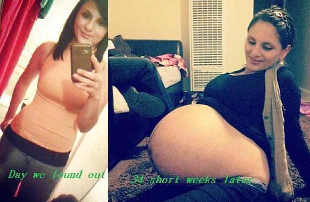 Before and After Pregnant Bellies #20205005