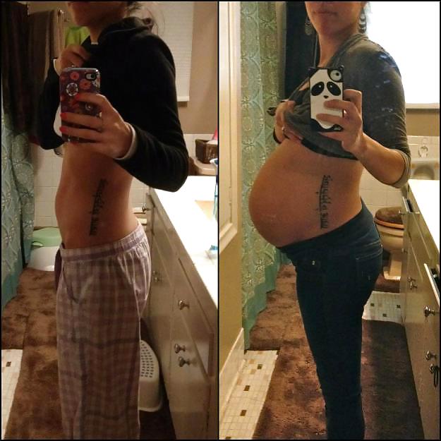 Antes y después de barrigas embarazadas
 #20205013