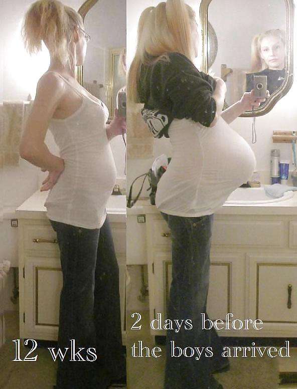 Antes y después de barrigas embarazadas
 #20205026