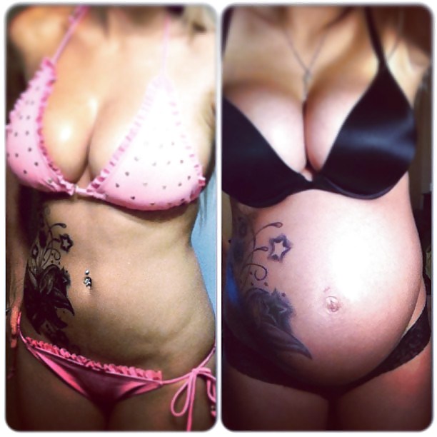 Antes y después de barrigas embarazadas
 #20205031