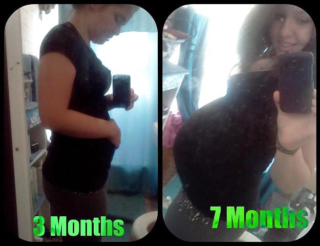 Antes y después de barrigas embarazadas
 #20205036