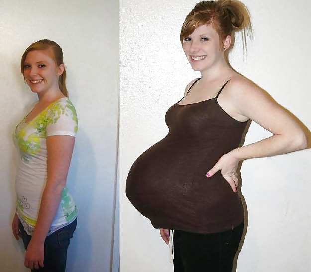 Antes y después de barrigas embarazadas
 #20205053