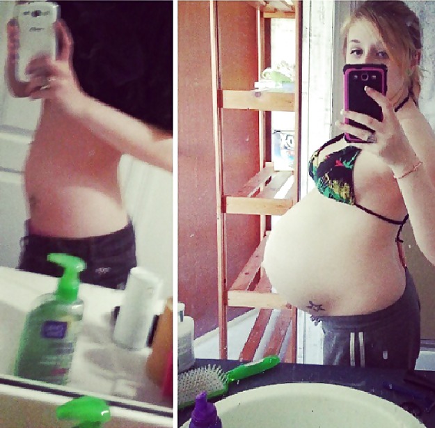 Antes y después de barrigas embarazadas
 #20205059