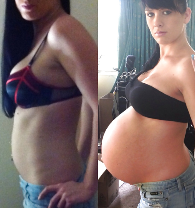 Antes y después de barrigas embarazadas
 #20205089