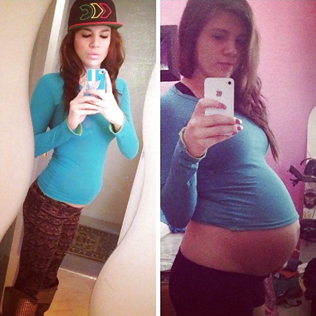Vor Und Nach Schwangere Bäuche #20205108