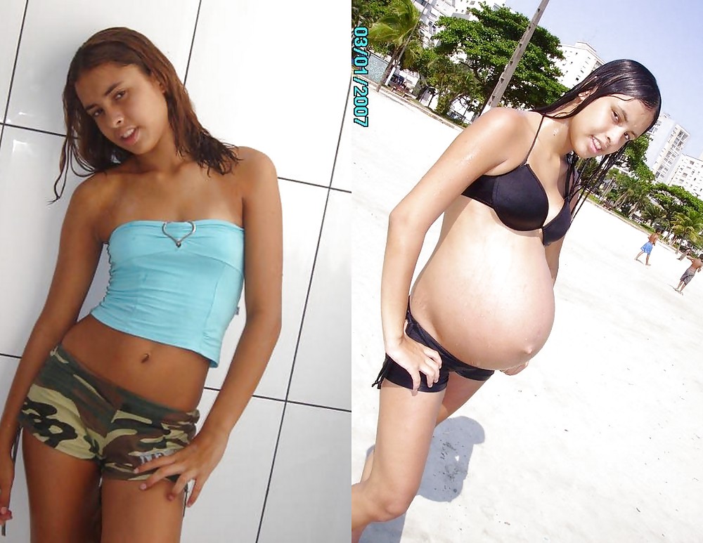 Antes y después de barrigas embarazadas
 #20205162