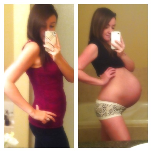 Antes y después de barrigas embarazadas
 #20205191