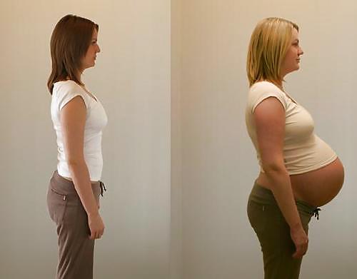 Antes y después de barrigas embarazadas
 #20205215