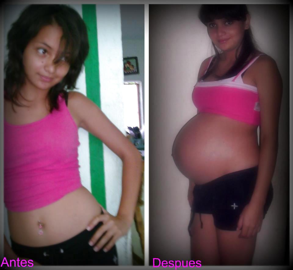 Antes y después de barrigas embarazadas
 #20205230