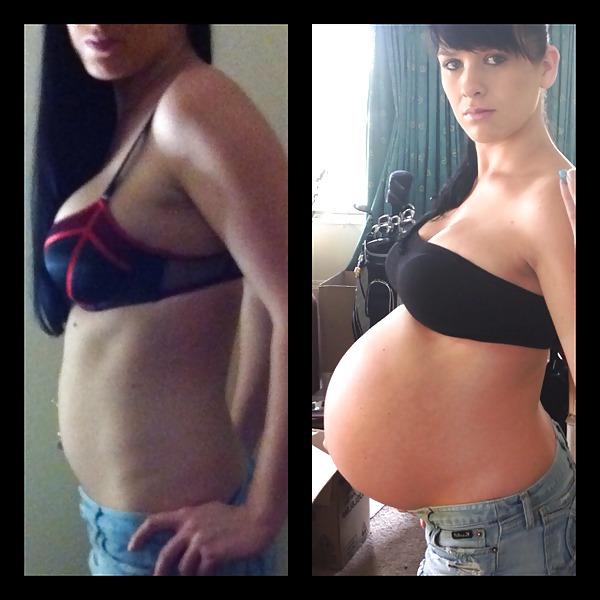 Antes y después de barrigas embarazadas
 #20205235