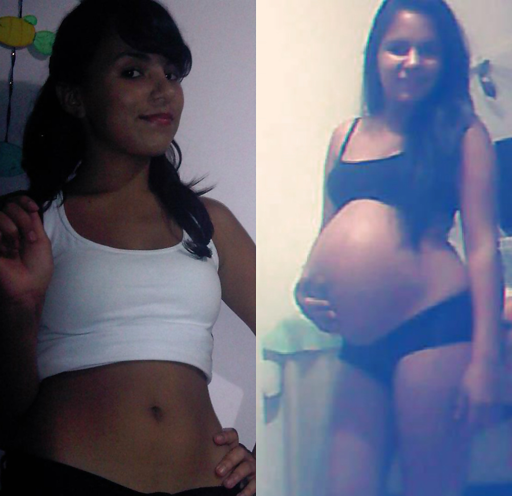Antes y después de barrigas embarazadas
 #20205243