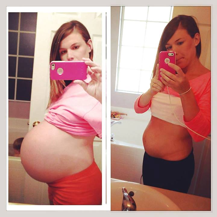 Antes y después de barrigas embarazadas
 #20205259