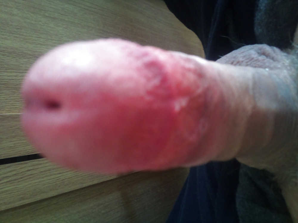 Rot Und Pochen #7199855