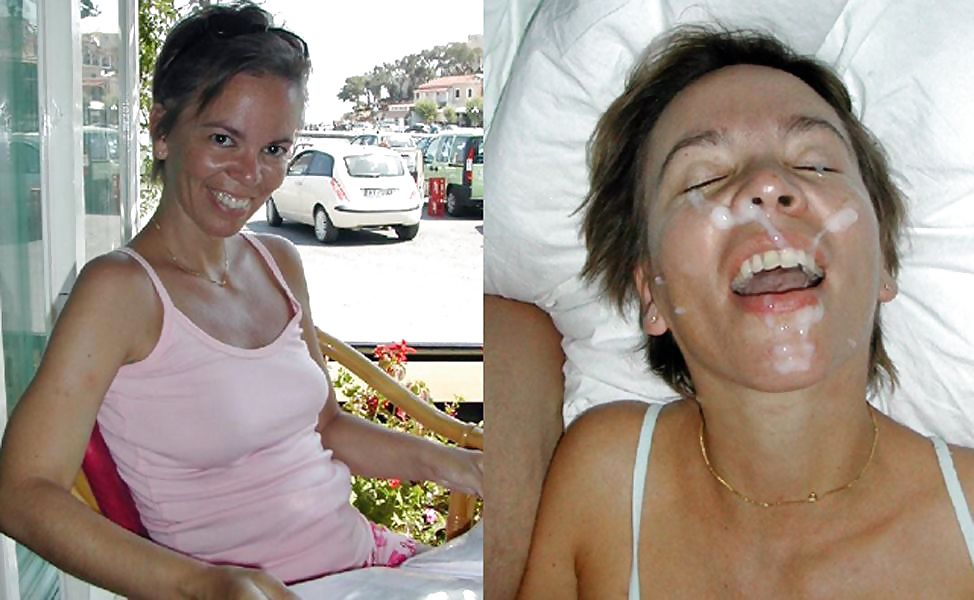Antes y después de los tratamientos faciales
 #20120810