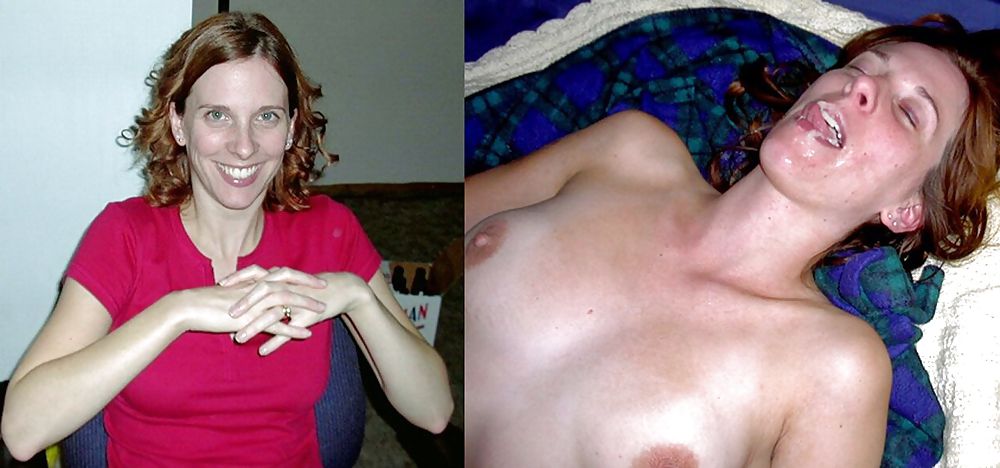 Prima e dopo i trattamenti del viso
 #20120843