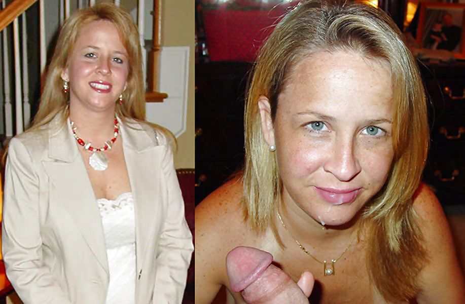 Antes y después de los tratamientos faciales
 #20120858