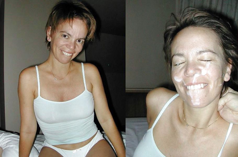 Prima e dopo i trattamenti del viso
 #20120866