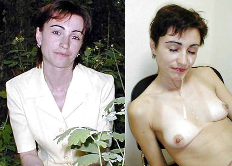 Prima e dopo i trattamenti del viso
 #20120876