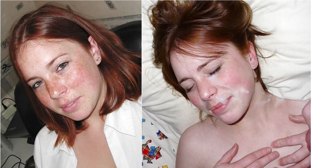 Prima e dopo i trattamenti del viso
 #20120882
