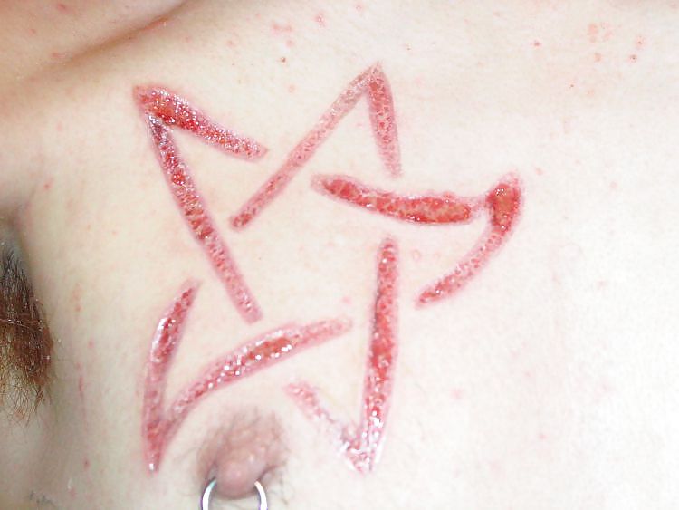 Scarification - children most in vogue physique modification #9454184